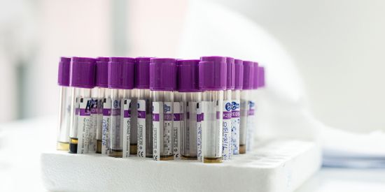 Blood samples from patients for viral load and HIV resistance testing. (Photo: Christian Heuss, SolidarMed)