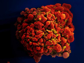 HIV-infected H9 T cell