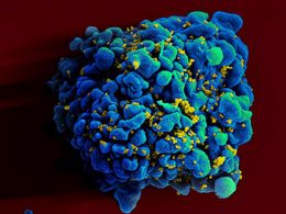 A T cell, a type of immune cell, is shown infected with HIV