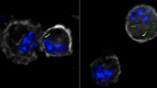 Mycobacterium tuberculosis-infected alveolar macrophages at day 10 after infection. Mtb in green.