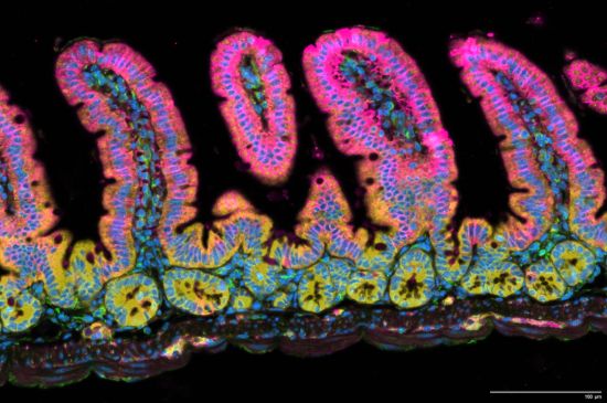 An image produced through Xenium analysis of mouse small intestines. Protruding “villi” stick up from the lining of the small intestine. Valley-like “crypts” fill in the gaps. Credit: Image from the Reina Lab, La Jolla Institute for Immunology