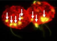 IMAGE: Spermatozoa (arrows) transmit HIV when they attach to dendritic cells (red).