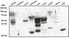 Figure from PNAS paper showing dark bands in columns