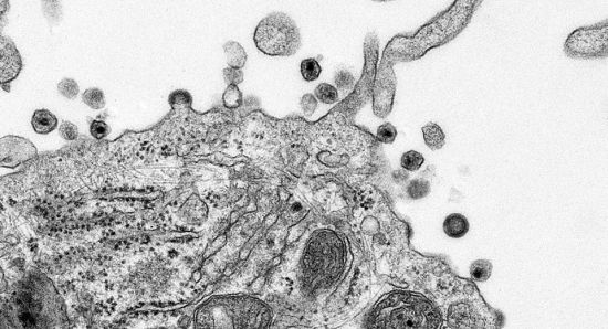 aids in process hiv infection of human lymphoid cd4 t cells