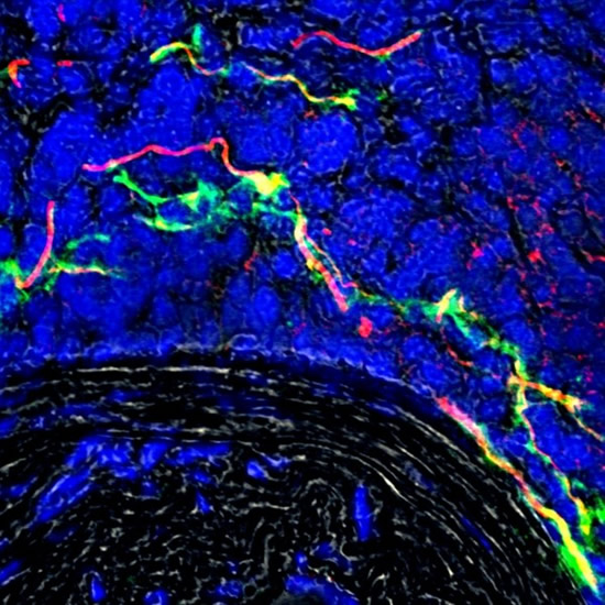 Growing Nerve bundles