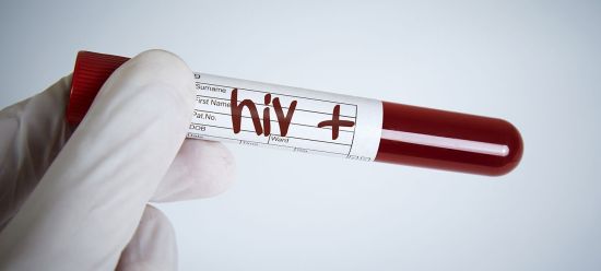 hiv