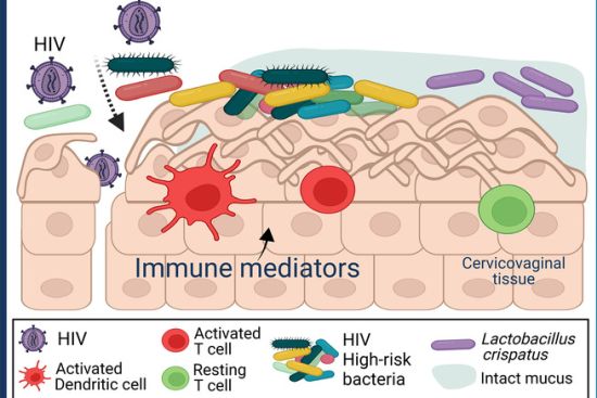 In the presence of certain bacterial vaginosis-associated bacteria, the mucosal barrier breaks down and immune cells are activated and become more susceptible to HIV infection (in red). Dr. Sujatha Srinivasan and colleagues identified 14 bacteria groups and six inflammatory proteins associated with high risk of HIV infection in women with bacterial vaginosis.
Adapted from Srinivasan, S. et al., J Infectious Diseases, 2024