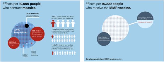 Image Caption: Fig 1. Comparing the risk of 10,000 children acquiring measles (left) versus receiving the measles-mumps-rubella (MMR) vaccine. A new original figure modified from [9]. Artwork by Fahim Akbar.
Image Credit: Hotez, 2025, PLOS Global Public Health, CC-BY 4.0 (https://creativecommons.org/licenses/by/4.0/) 