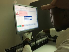 A lab technician in Lesotho prepares blood samples to measure viral load. (Photo: Niklaus Labhardt, SolidarMed)