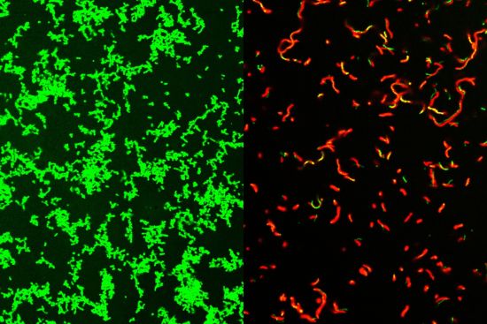 IMAGE: Researchers at Washington University School of Medicine in St. Louis have developed a potential drug that is effective against common bacteria that can lead to rare, dangerous illnesses. Shown on the left are untreated Streptococcus pyogenes bacteria. After treatment with the compound, the dish is full of dead bacteria (image on right).