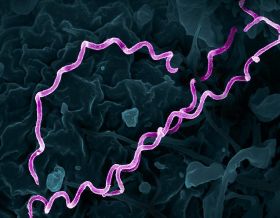 Colorized electron micrograph of Treponema pallidum, the bacteria that cause syphilis. Several spiral-shaped bacteria have been highlighted in pink.NIAID